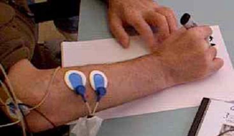 Location of EMG electrodes