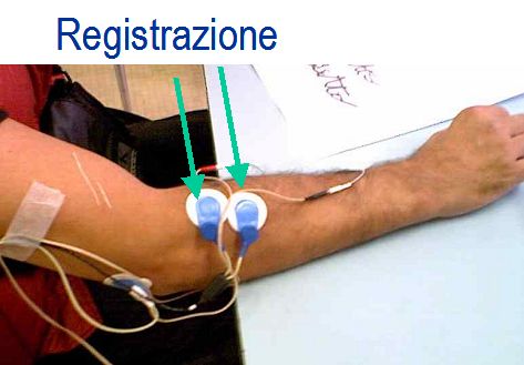 Location of EMG electrodes